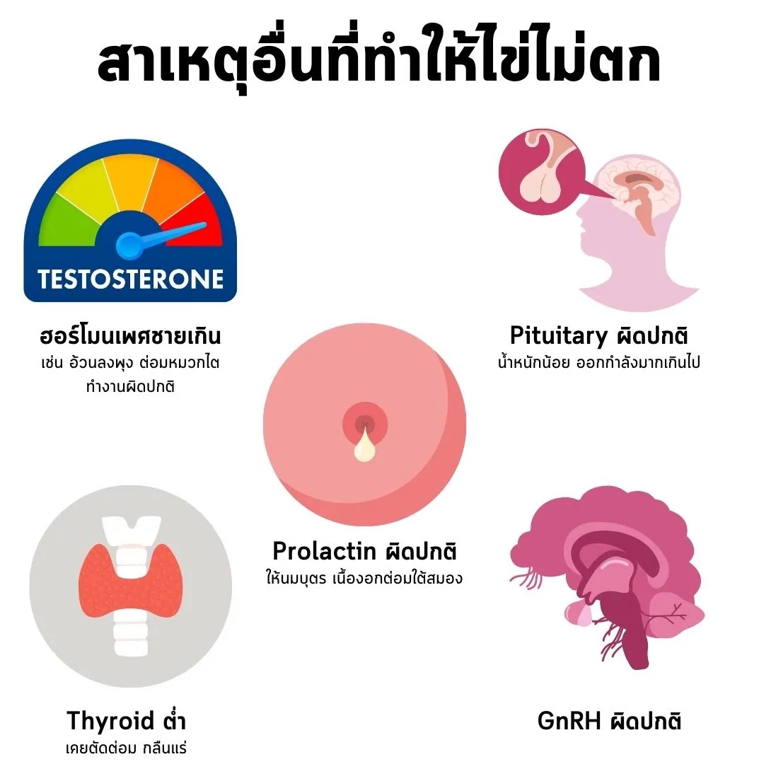 สาเหตุอื่นที่ทำให้ไข่ไม่ตก ได้แก่ ฮอร์โมนเพศชายเกิน Pituitary ผิดปกติ Prolactin ผิดปกติ Thyroid ต่ำ และ GnRH ผิดปกติ